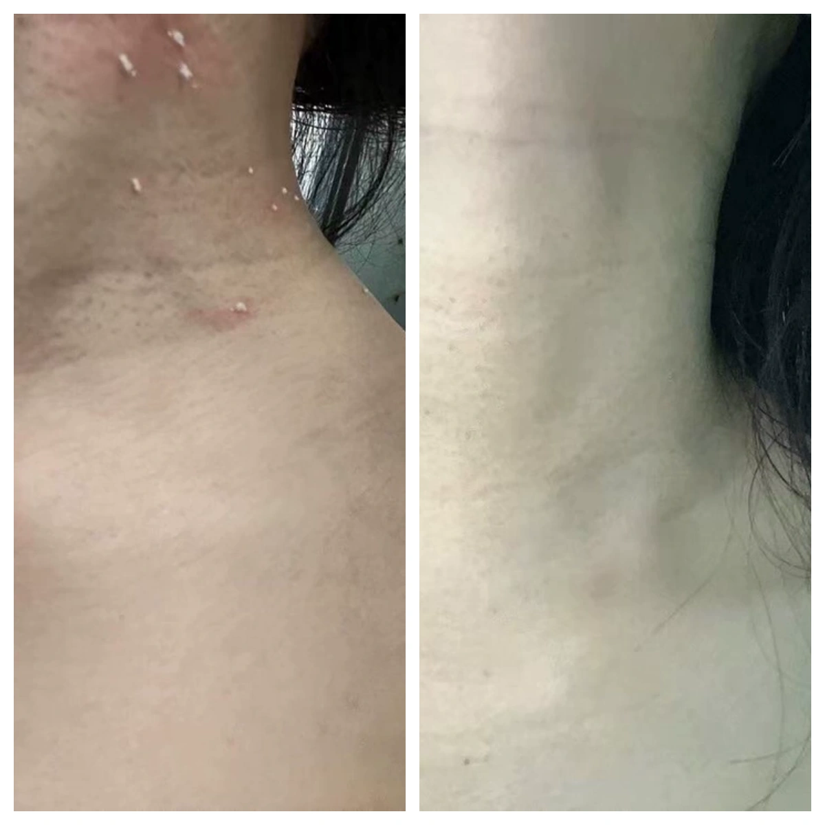 КРІО-СПРЕЙ ДЛЯ ВІДНОВЛЕННЯ