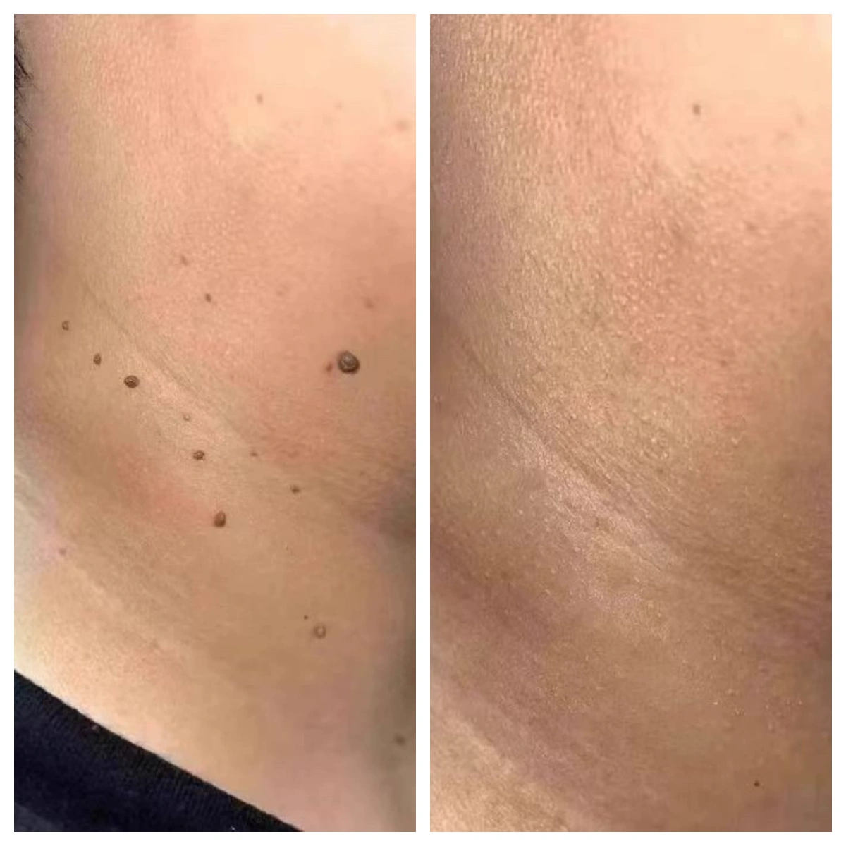 КРІО-СПРЕЙ ДЛЯ ВІДНОВЛЕННЯ