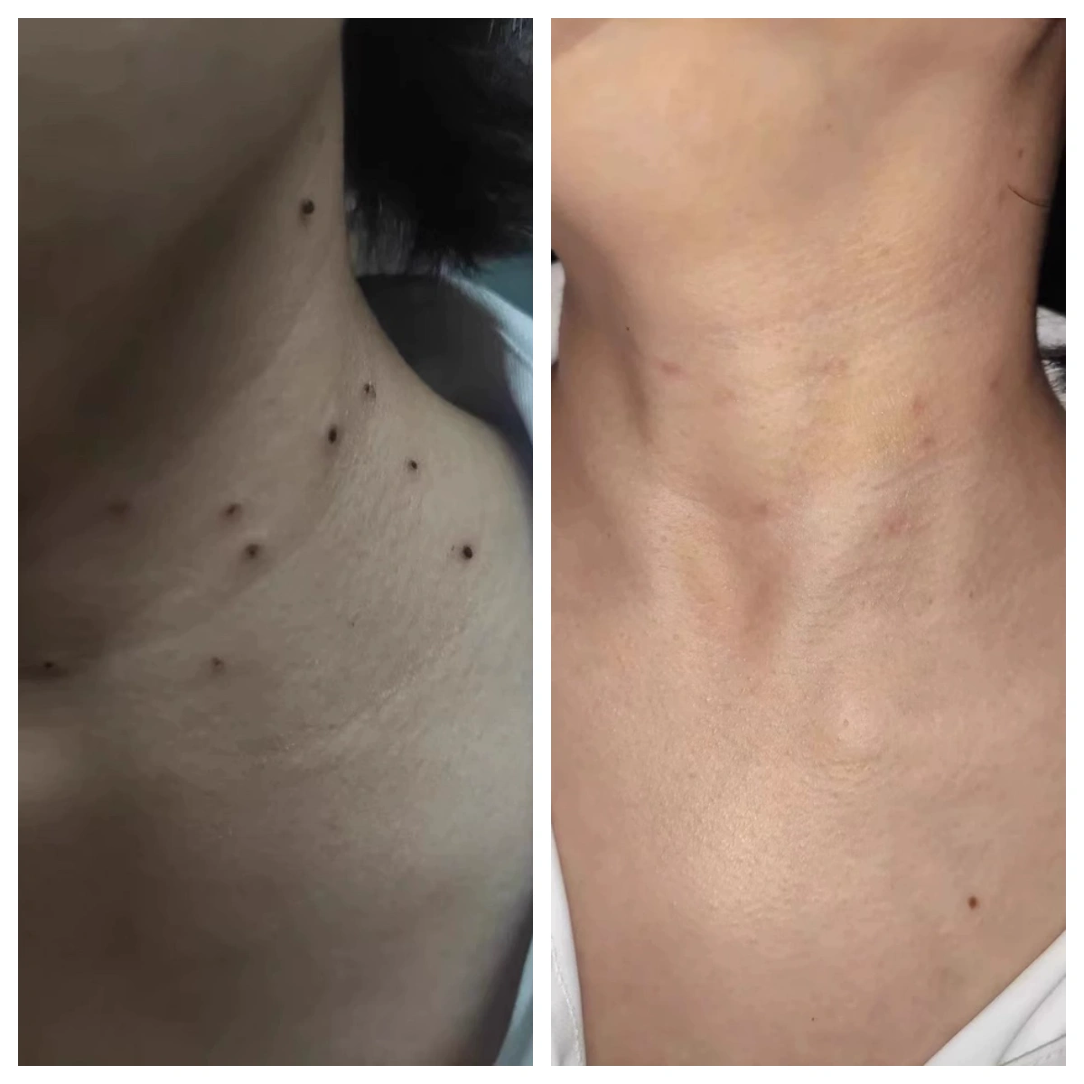 КРІО-СПРЕЙ ДЛЯ ВІДНОВЛЕННЯ